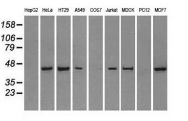 Anti-PPP1R7 antibody [3E7] used in Western Blot (WB). GTX83842