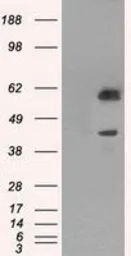 Anti-PPP1R7 antibody [3E7] used in Western Blot (WB). GTX83842