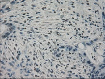 Anti-PPP1R7 antibody [4F9] used in IHC (Paraffin sections) (IHC-P). GTX83843