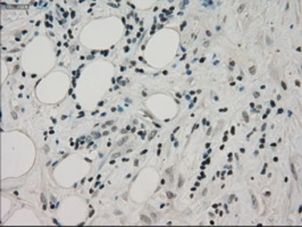 Anti-PPP1R7 antibody [4F9] used in IHC (Paraffin sections) (IHC-P). GTX83843