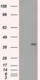 Anti-PPP1R7 antibody [4F9] used in Western Blot (WB). GTX83843