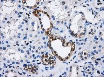 Anti-PPME1 antibody [7F12] used in IHC (Paraffin sections) (IHC-P). GTX83847