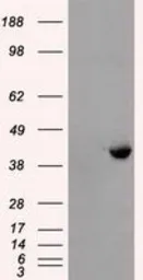 Anti-PPME1 antibody [7F12] used in Western Blot (WB). GTX83847