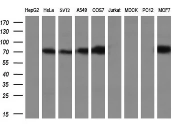 Anti-POR antibody [6C4] used in Western Blot (WB). GTX83854