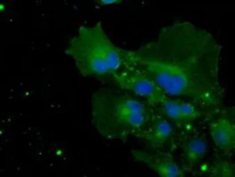 Anti-POR antibody [6C4] used in Immunocytochemistry/ Immunofluorescence (ICC/IF). GTX83854