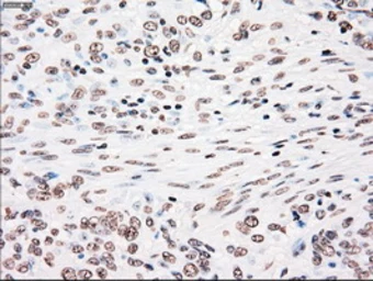 Anti-PLK1 antibody [1D4] used in IHC (Paraffin sections) (IHC-P). GTX83865
