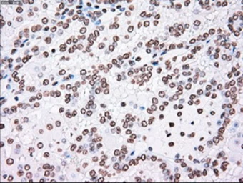 Anti-PLK1 antibody [1D4] used in IHC (Paraffin sections) (IHC-P). GTX83865