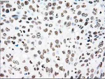 Anti-PLK1 antibody [1D4] used in IHC (Paraffin sections) (IHC-P). GTX83865