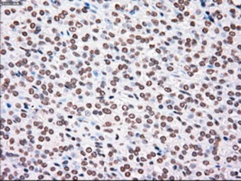 Anti-PLK1 antibody [1D4] used in IHC (Paraffin sections) (IHC-P). GTX83865
