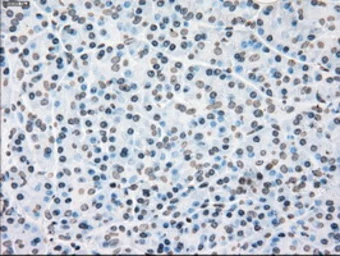Anti-PLK1 antibody [1D4] used in IHC (Paraffin sections) (IHC-P). GTX83865