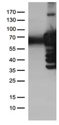 Anti-PLK1 antibody [1D4] used in Western Blot (WB). GTX83865