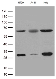 Anti-PLK1 antibody [8C12] used in Western Blot (WB). GTX83866