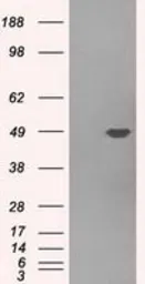 Anti-Pleckstrin antibody [4F10] used in Western Blot (WB). GTX83873