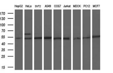 Anti-PKMYT1 antibody [2B4] used in Western Blot (WB). GTX83875