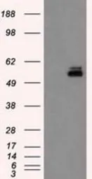 Anti-PKMYT1 antibody [2B4] used in Western Blot (WB). GTX83875