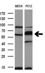 Anti-PKMYT1 antibody [1C3] used in Western Blot (WB). GTX83876