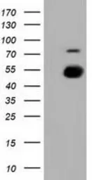 Anti-PKMYT1 antibody [1C3] used in Western Blot (WB). GTX83876