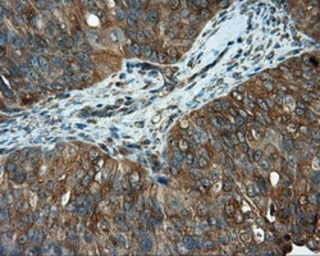 Anti-PIM2 antibody [10A12] used in IHC (Paraffin sections) (IHC-P). GTX83886