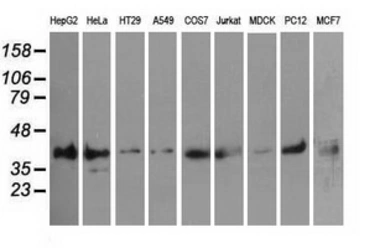 Anti-PIM2 antibody [10A12] used in Western Blot (WB). GTX83886