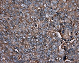 Anti-PIM2 antibody [5D5] used in IHC (Paraffin sections) (IHC-P). GTX83887