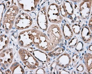 Anti-PIM2 antibody [5D5] used in IHC (Paraffin sections) (IHC-P). GTX83887
