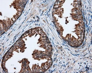 Anti-PIM2 antibody [5D5] used in IHC (Paraffin sections) (IHC-P). GTX83887