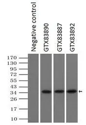 Anti-PIM2 antibody [5D5] used in Immunoprecipitation (IP). GTX83887