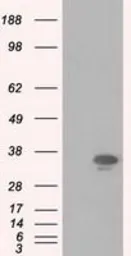 Anti-PIM2 antibody [5D5] used in Western Blot (WB). GTX83887