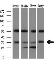 Anti-PIM2 antibody [5D5] used in Western Blot (WB). GTX83887