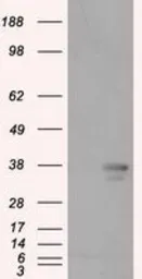Anti-PIM2 antibody [8G10] used in Western Blot (WB). GTX83890