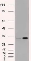 Anti-PIM2 antibody [9A5] used in Western Blot (WB). GTX83892