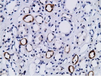 Anti-PIK3AP1 antibody [7A11] used in IHC (Paraffin sections) (IHC-P). GTX83893