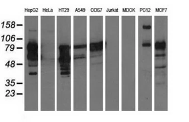 Anti-PIK3AP1 antibody [6H6] used in Western Blot (WB). GTX83896