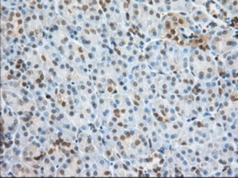 Anti-Profilin 1 antibody [2D2] used in IHC (Paraffin sections) (IHC-P). GTX83902