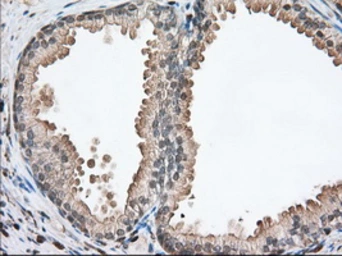 Anti-Profilin 1 antibody [2D2] used in IHC (Paraffin sections) (IHC-P). GTX83902