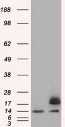 Anti-Profilin 1 antibody [2D2] used in Western Blot (WB). GTX83902
