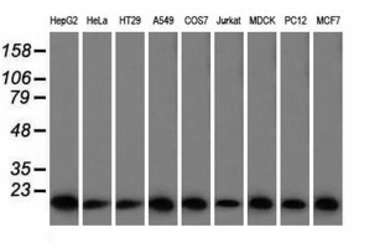 Anti-Profilin 1 antibody [2D2] used in Western Blot (WB). GTX83902
