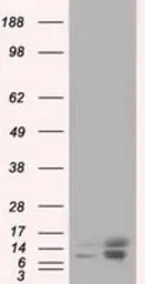 Anti-Profilin 1 antibody [1D5] used in Western Blot (WB). GTX83903