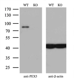 Anti-PEX5 antibody [6E9] used in Western Blot (WB). GTX83905