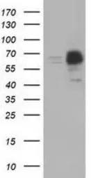 Anti-PEX5 antibody [6E9] used in Western Blot (WB). GTX83905