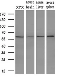 Anti-PEPD antibody [1B7] used in Western Blot (WB). GTX83909
