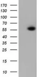 Anti-PEPD antibody [1B7] used in Western Blot (WB). GTX83909