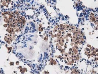 Anti-PEPD antibody [5D5] used in IHC (Paraffin sections) (IHC-P). GTX83910