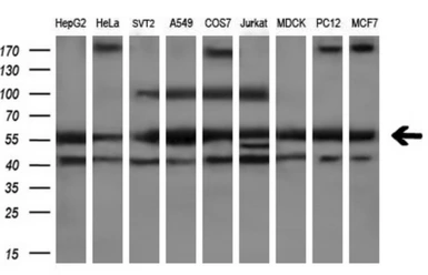 Anti-PEPD antibody [5D5] used in Western Blot (WB). GTX83910