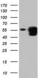 Anti-PEPD antibody [5D5] used in Western Blot (WB). GTX83910