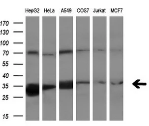 Anti-PECR antibody [1C9] used in Western Blot (WB). GTX83914