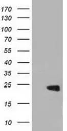 Anti-RKIP antibody [2D4] used in Western Blot (WB). GTX83917
