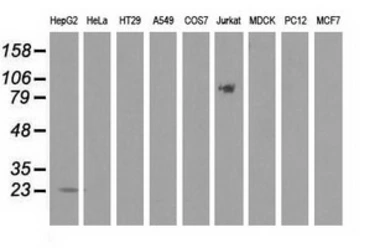 Anti-RKIP antibody [2D4] used in Western Blot (WB). GTX83917