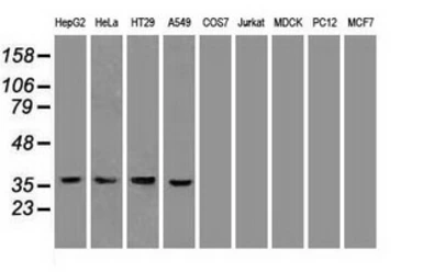 Anti-PDX1 antibody [5D5] used in Western Blot (WB). GTX83918