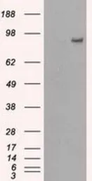 Anti-PDE10A antibody [1B2] used in Western Blot (WB). GTX83931
